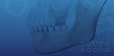 Bone Graft (per unit)